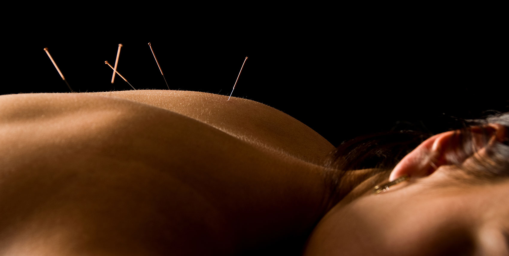 Misun Oh Acupuncture & Herbs, Dayton, Centerville, Ohio