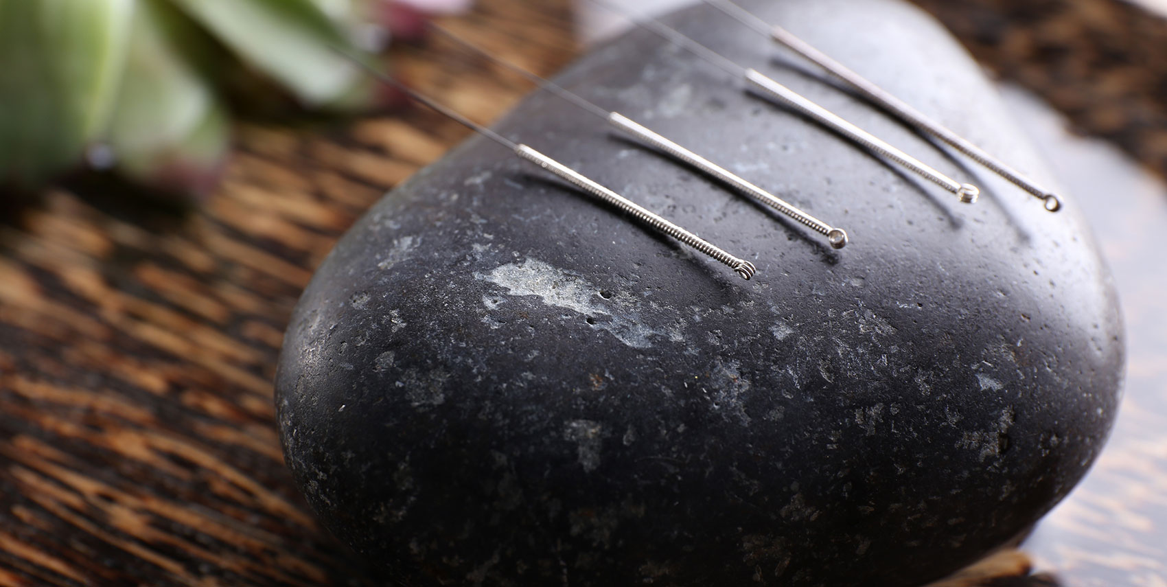 Misun Oh Acupuncture Testimonials, Dayton, Centerville, Ohio